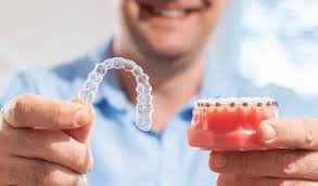 orthodontist services in Rayasandra