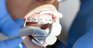 orthodontist services in Rayasandra