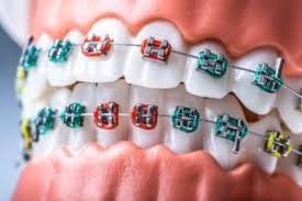 orthodontist services in Rayasandra