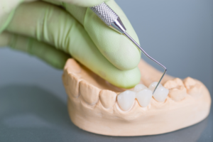 Dental Treatment in kasavanahalli