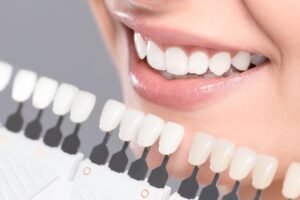 Gum Treatment In Hsr Layout