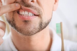 Gum Treatment In Kasavanahalli
