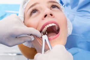 Tooth Extraction in kasavanahalli