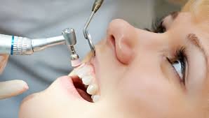 Professional dental care for adults in HSR Layout