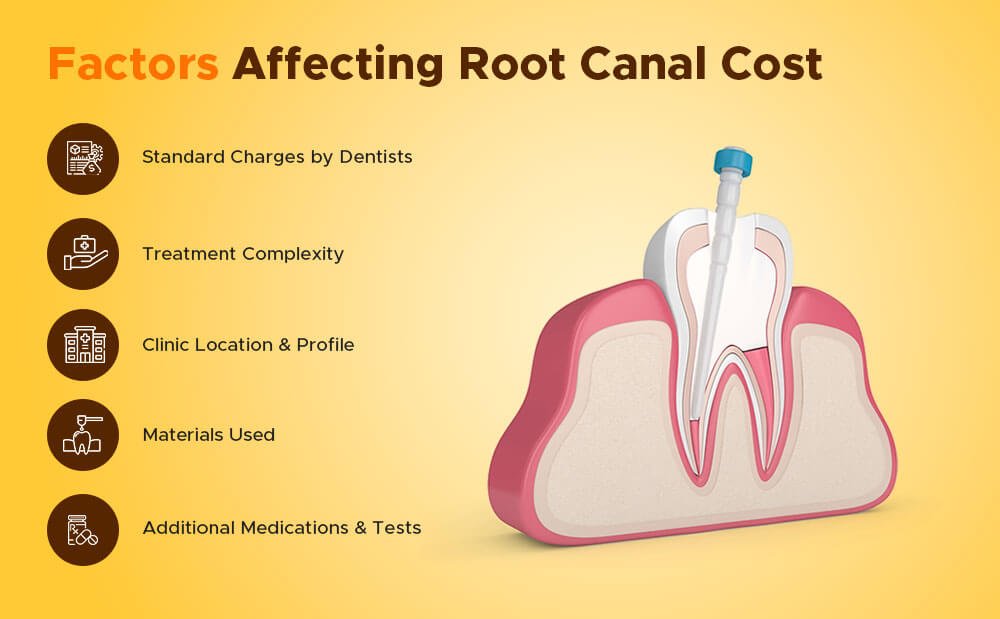 affordable root canal near Kasavanhalli Bangalore