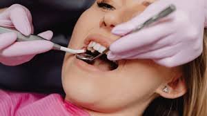 dental check-up near Kasavanhalli Main Road