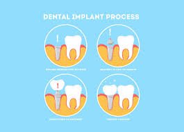 dental services near Mahaveer Ranches Bangalore