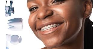 orthodontist services in Rayasandra