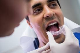 orthodontist services in Rayasandra