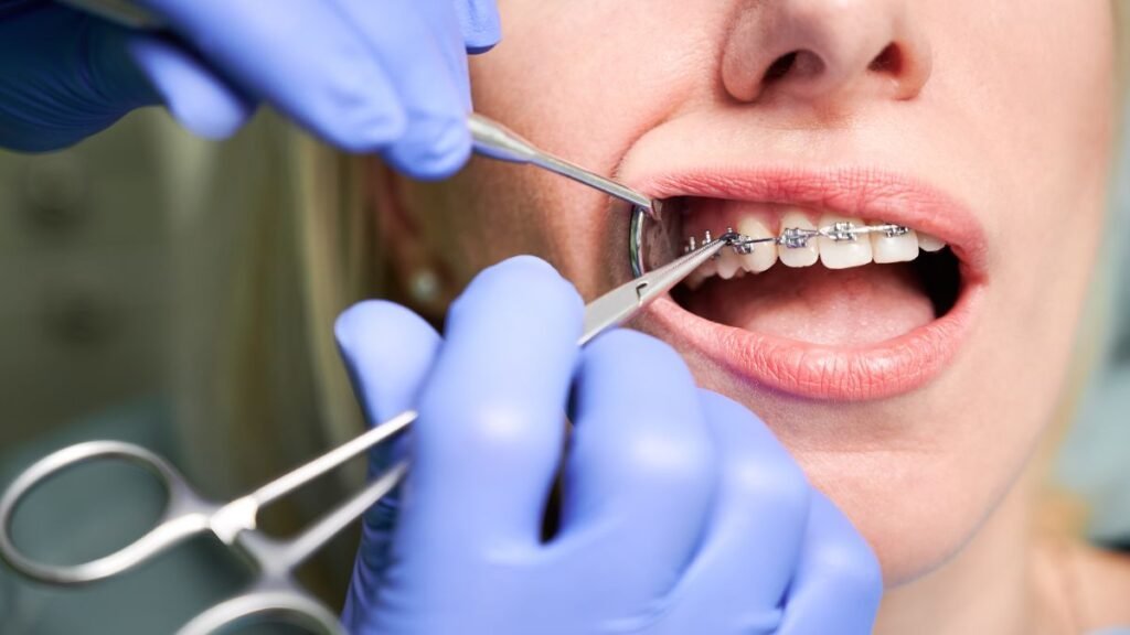 best dentist near me in Kasavanhalli