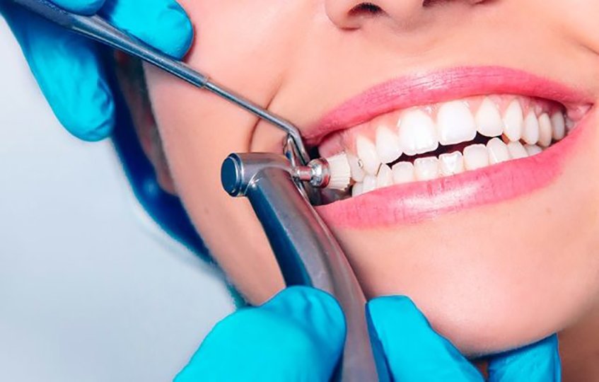 dental services near Jayanagar Bangalore