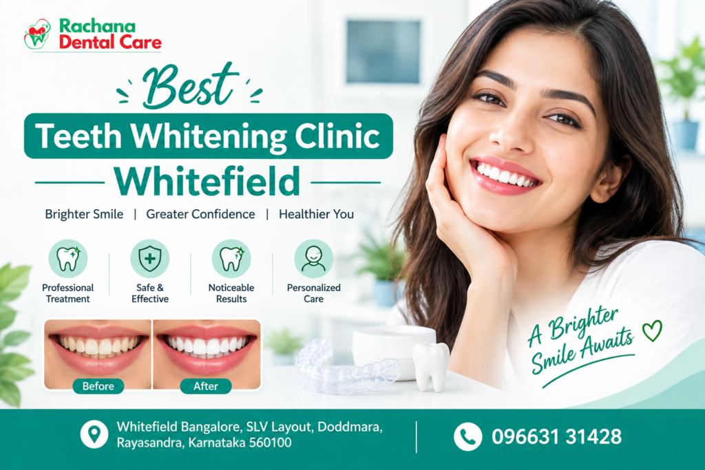 Best Teeth Whitening Clinic Whitefield